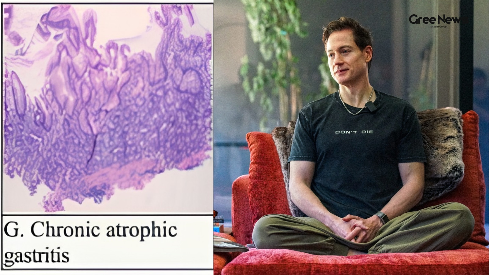 Understanding Autoimmune Gastritis and Digestive Health