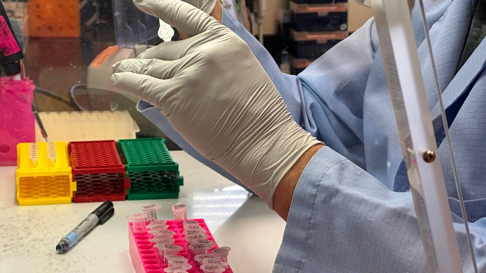 Hantavirus Situation on MV Hondius and Infection Control