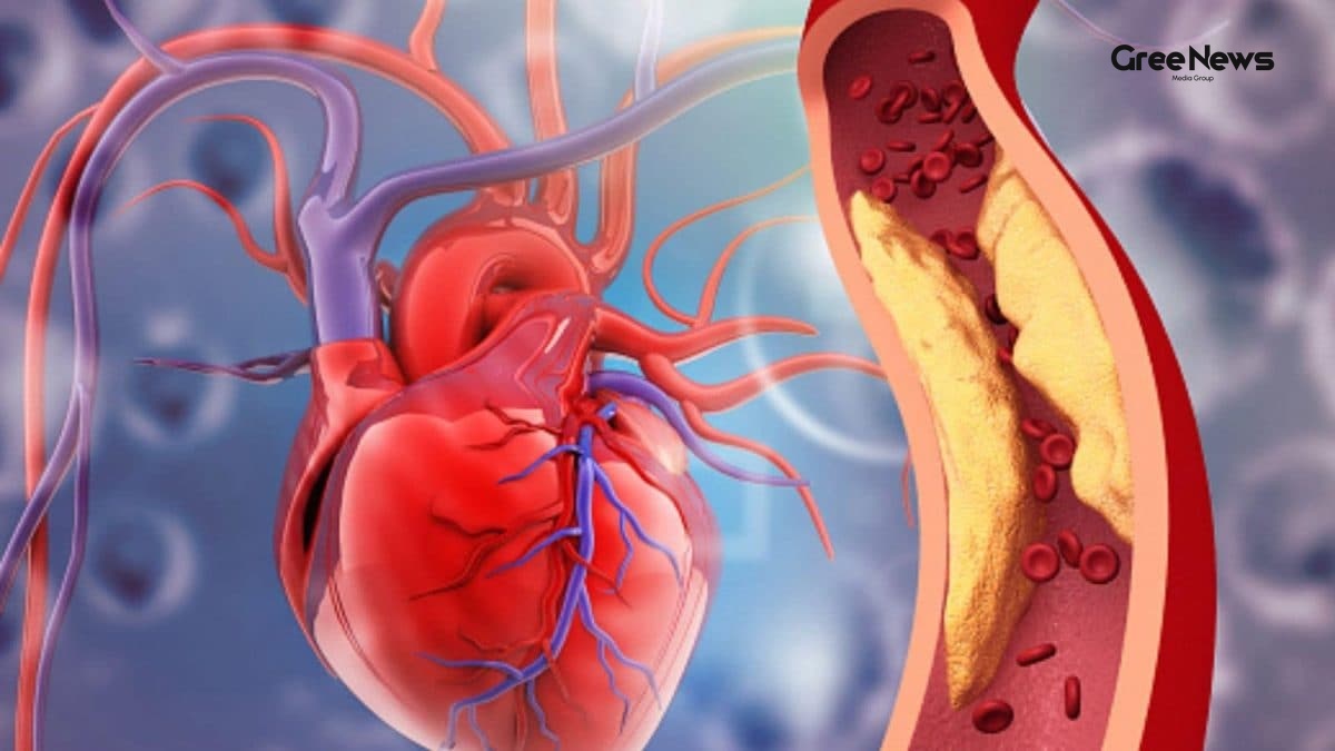 Why a ‘Normal’ ECG Might Still Hide a Heart‑Attack Risk  Lessons from a Recent Indian Study