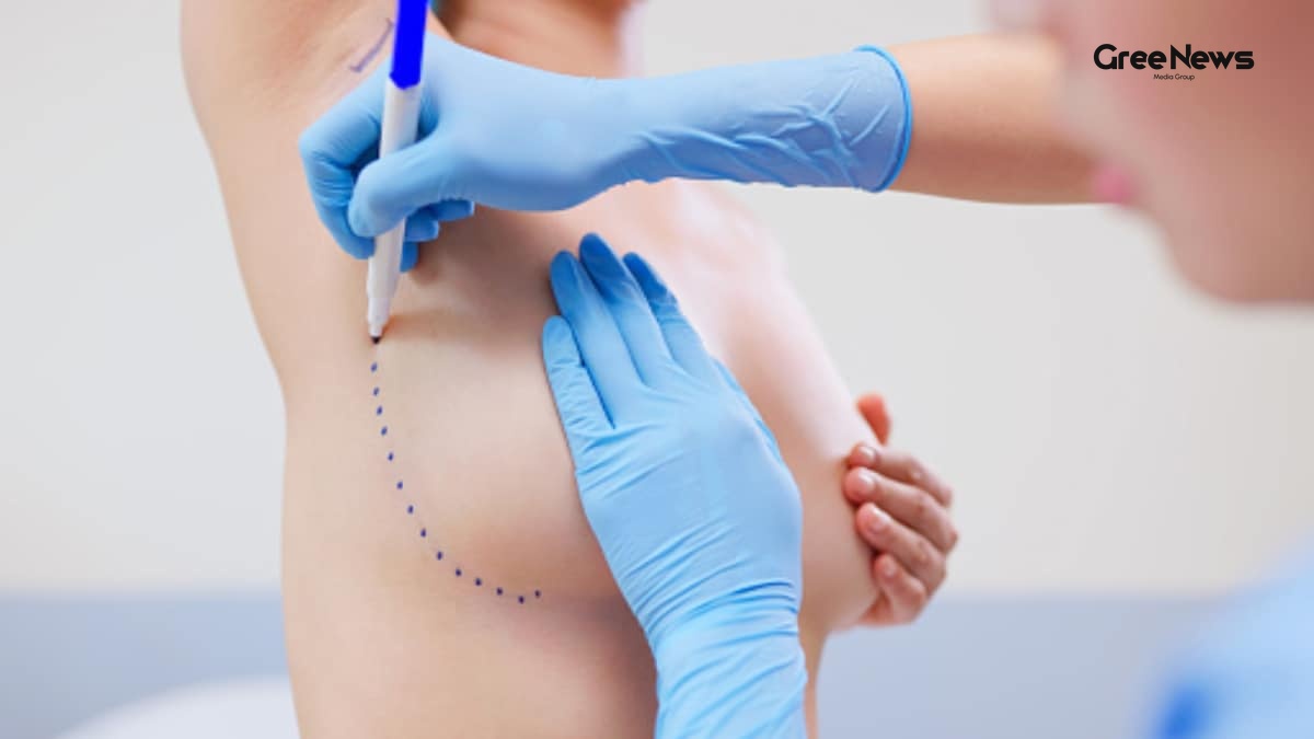 Why Breast Reconstruction Must Become Part of Everyday Cancer Care in India